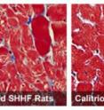 Heart muscle cells in untreated rats bred to develop heart failure show signs of disease. Right: Heart muscle cells remain healthy in rats treated with calcitriol, the hormone that Vitamin D becomes in the body. Heart muscle cells in untreated rats bred to develop heart failure show signs of disease. Right: Heart muscle cells remain healthy in rats treated with calcitriol, the hormone that Vitamin D becomes in the body.