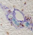 Liver stem cells expressing FoxL1 (aqua blue) in an injured mouse liver near the bile duct. The FoxL1-containing stem cells are encircled by liver fibroblasts (royal blue), suggestive of a stem cell niche. Liver stem cells expressing FoxL1 (aqua blue) in an injured mouse liver near the bile duct. The FoxL1-containing stem cells are encircled by liver fibroblasts (royal blue), suggestive of a stem cell niche.