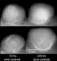 X-ray images showing two tumors with different levels of "leakiness." Tumor A exhibits higher grey levels than tumor B by 40 and 70 digital units at 72 and 120 hours post-injection, respectively. X-ray images showing two tumors with different levels of "leakiness." Tumor A exhibits higher grey levels than tumor B by 40 and 70 digital units at 72 and 120 hours post-injection, respectively.