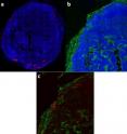 Fluorescent microscopy breast tumor images that demonstrate the intensity changes in the X-ray images were caused by the nanocarrier and not endogenous changes in the tumor tissue. (A) 48 hours after injecting liposomes tagged with a red fluorescent dye, the liposomes appear in a patchy distribution in the periphery of the tumor. (B) A green immunohistochemical microvascular stain reveals the tumor has a highly vascularized peripheral rim and a less vascularized inner core. (C) In the same histological slice, the nanocarriers containing red contrast agent appear localized within the well vascularized rim. Fluorescent microscopy breast tumor images that demonstrate the intensity changes in the X-ray images were caused by the nanocarrier and not endogenous changes in the tumor tissue. (A) 48 hours after injecting liposomes tagged with a red fluorescent dye, the liposomes appear in a patchy distribution in the periphery of the tumor. (B) A green immunohistochemical microvascular stain reveals the tumor has a highly vascularized peripheral rim and a less vascularized inner core. (C) In the same histological slice, the nanocarriers containing red contrast agent appear localized within the well vascularized rim.