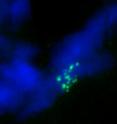 This photo shows chromosome strands misaligned without linker histone H1 in a
fly with reduced H1 levels -- H1KD.
