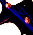Researchers at Purdue have precisely measured the impact of a high-fat diet on the spread of cancer, finding that excessive dietary fat caused a 300 percent increase in metastasizing tumor cells in laboratory animals. Here, lipid-rich cancer cells (the two round objects) attach to collagen fibrils, simultaneously visualized using coherent anti-Stokes Raman scattering and sum frequency generation imaging. Cancer cells attach to collagen before spreading to organs in the body. Researchers at Purdue have precisely measured the impact of a high-fat diet on the spread of cancer, finding that excessive dietary fat caused a 300 percent increase in metastasizing tumor cells in laboratory animals. Here, lipid-rich cancer cells (the two round objects) attach to collagen fibrils, simultaneously visualized using coherent anti-Stokes Raman scattering and sum frequency generation imaging. Cancer cells attach to collagen before spreading to organs in the body.