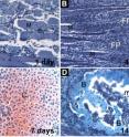 These are stages of metamorphosis of muscle tissue into bone tissue in mouse model of heterotopic ossification (misplaced bone growth). A: Inflammation in muscle tissue (M = muscle cells). B: Destruction of muscle cells (FP = fibroproliferation). C: Formation of cartilage scaffold before bone formation (C = cartilage). D: Formation of mature bone (B = bone) These are stages of metamorphosis of muscle tissue into bone tissue in mouse model of heterotopic ossification (misplaced bone growth). A: Inflammation in muscle tissue (M = muscle cells). B: Destruction of muscle cells (FP = fibroproliferation). C: Formation of cartilage scaffold before bone formation (C = cartilage). D: Formation of mature bone (B = bone)