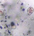 Pictured is a micrograph of siderite crystals with the red showing hematite inside. The dark blue is magnatite and pyrite. Pictured is a micrograph of siderite crystals with the red showing hematite inside. The dark blue is magnatite and pyrite.