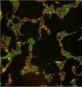 Ampliación de la E. coli expuesta a una baja concentración (10 mg/l) de nanopartículas de dióxido de titanio. Las células con membranas deterioradas presentan una coloración roja. Foto: Universidad de Toledo (Ohio, EE UU).