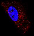 Image of an epithelial cell showing 1,400 native mRNA granules (red) detected using probes designed at Georgia Tech. It is composed of superimposed images taken at several heights above and below the nucleus (blue). Image of an epithelial cell showing 1,400 native mRNA granules (red) detected using probes designed at Georgia Tech. It is composed of superimposed images taken at several heights above and below the nucleus (blue).