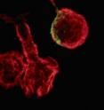 This is the actin cytoskeleton of human T-lymphocytes (red) in the presence of the stimulus CCL-19. An HIV-1 infection (HIV-1 protein CA in green) leads to the loss of actin reorganization and therefore of cell motility. This is the actin cytoskeleton of human T-lymphocytes (red) in the presence of the stimulus CCL-19. An HIV-1 infection (HIV-1 protein CA in green) leads to the loss of actin reorganization and therefore of cell motility.