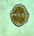 A cell of the dinoflagellate Lingulodinium polyedrum.