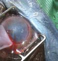 Dixie's cloudy cornea is removed by Grozdanic before the new, plastic cornea is implanted.
