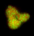 Archaea in the picture in red, sulfate reducing Bacteria in green.
Microscopic image of a AOM consortia after Fluorescent in situ hybridization. The samples are from deep sea sediments off the coast of California near Monterey.