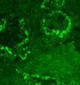 Deposits of hydroxyapatite crystal (l.) and the same mineral in a cross section of a human tooth (r.) light up bright green where they’ve been tagged with a new peptide created at NIST to bond specifically to the compound. The peptide has been linked to a fluorescent stain for imaging.