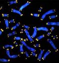 Immune cells (stained blue) end in protective caps called telomeres (stained yellow) that are shorter in the elderly -- and in persons suffering chronic stress. A new UCLA study suggests cortisol is the culprit behind premature aging of the immune system in stressed-out people.