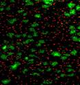 Biofilm in green, amoebae in red.