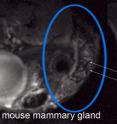 MRI of DCIS in mouse mammary gland.