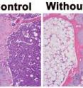 Left panel: normal bone marrow tissue. Right panel: bone marrow with deletion of the Cul4A gene and loss of its protein.