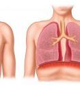 Normal vs. diseased emphysema lung.