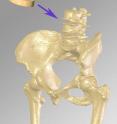 Monolith in relation to lumbar spine.