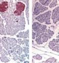 More insulin-positive cells (brown)
occur in mice lacking leptin-making fat
cells (left) than in control mice (right).