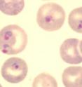 Pictured is the malarial parasite <I>Plasmodium berghei</I>, which is found in African thicket rats.