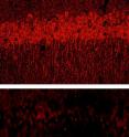 The extracellular matrix thins in mice
lacking laminin in the hippocampus
(bottom).