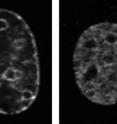 Oct-1 localizes to the nuclear
envelope in wild-type (left) but
not lamin B mutant cells (right).