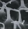 This is the ventral surface of book lung lamella with branched trabeculae in <i>Opisthacanthus elatus</i> (3 µm).