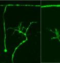 All three photos show severed nerves from nematode worms. Axons -- the wiry part of nerve cells -- had stretched from top to bottom but were cut by a laser beam. In each case, the "stump" of the severed nerve hangs downward from the top. In the left image, the nerve regeneration gene dlk-1 operates normally -- which means not very well -- so the upward-growing axon branches too much and lacks what is known as a "growth cone," so it never reaches the major nerve that runs horizontally near the top of each image. In the center photo, the regeneration gene has been over-activated, so it grows upward with a normal growth cone and not too many branches, allowing it to eventually reach the major nerve. The right image shows the severed nerve in a worm in which the regeneration gene was crippled, so there is no regeneration of the nerve axon, just stumps at top and bottom.