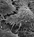 Scanning electron microscope image of Ebola virions (spaghetti-like filaments) on the surface of a tetherin-expressing cell (center). The other three cells seen in this image (upper right and upper and lower left) do not have the filamentous virus on their surfaces. Scanning electron microscope image of Ebola virions (spaghetti-like filaments) on the surface of a tetherin-expressing cell (center). The other three cells seen in this image (upper right and upper and lower left) do not have the filamentous virus on their surfaces.