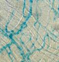 In the cell walls of small blood vessels -- here stained blue -- proteins are mediators of anaphylactic shock.