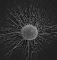 This is a polysaccharide capsule of <i>C. neoformans</i> by Scanning Electron microscopy.