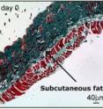 In these images of stained normal mouse wound tissue (left), and mouse tissue with RHAMM blocked, the green stain shows collagen, the white layers are fat, and the red stain highlights keratinocytes, hair follicles and muscle. The images show that the subcutaneous fat layers in the RHAMM blocked tissue are significantly thicker than those of the normal mouse wound tissue.