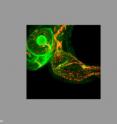 This is the enlarged heart of a 48-hour-post-fertilization zebrafish embryo lacking the gene for ccm2. Nuclei from endothelial cells are red and junctions in between are green.