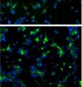 The top image shows neural precursor cells generate glial cells (shown in green) after being stimulated with retinoic acid or cytokines. The bottom image shows neural precursor cells making more synaptojanin-1 protein produce more glial cells.
