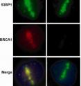 BRCA1 (red) readily localizes to laser-induced DNA damage sites demarcated by the DNA repair protein (green) in control cells (left column). BRCA1 recruitment to DNA damage sites is strongly reduced in MERIT40-deficient cells (right column).