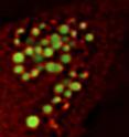 Spartin (red) localizes on the surface of lipid droplets (green).