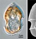 <I>Azadinium spinosum</i> causes mussel poisoning by the production of azaspiracid (left: light microscopic image, right: SEM).