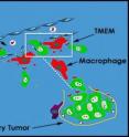 Metastasis requires the presence of three cells in the same microanatomic site: a tumor cell that produces the protein MENA; a macrophage (cells that guide tumor cells to blood vessels); and a blood-vessel endothelial cell. The presence of three such cells in contact with each other is called a tumor microenvironment of metastasis, or TMEM, which is depicted within the rectangle in this illustration.