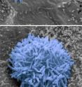 These are inner ears with normal mouse hair cells (top) and without (bottom).