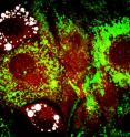 Purdue researchers have uncovered new evidence that factors other than genes could cause obesity, finding that genetically identical cells store widely differing amounts of fat depending on subtle variations in how cells process insulin. Here, insulin (green) is present in cells with no fat storage and absent in cells with fat storage at two days after insulin addition. This observation indicates faster insulin processing rates in cells with fat storage. Fluorophore-labeled insulin (green) is visualized with fluorescence imaging, and fat is visualized with coherent anti-Stokes Raman scattering -- or CARS -- imaging (red/white).