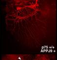 The top image shows the neuronal wiring (red) of the heart in Alzheimer's mice appears normal. The bottom image shows the sympathetic innervation in p75-deficient Alzheimer's mice is severely impaired.