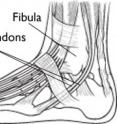 Line drawing of an ankle, showing where the peroneal tendons are located.