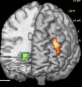 This shows areas in the prefrontal cortex (right) and hippocampus (left) where activity differed in healthy control subjects during thinking tasks, depending on whether they had the risk version of the KCNH2 potassium channel gene. The image is made from functional magnetic resonance imaging data superimposed on 3-D MRI reconstruction of the brain.