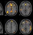 These are fMRI brain scans from UBC Mind Wandering Study.