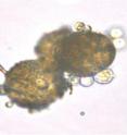 Labyrinthulomycetes from Peconic Bay are shown growing on pollen grains.
