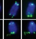 This is a series of images showing chromosomes with fragile telomeres (green). Without the protein TRF1, telomeres resemble common fragile sites, unstable regions on chromosomes that break into segments or stretch due to faulty DNA replication.