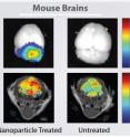 This image shows a mouse brain tumor imaged using nanoparticles (left column) or conventional techniques (right column) combined with optical imaging and MRI. The nanoparticles give a clearer picture of the tumor, which is located at the back of the brain in the cerebellum.