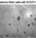 These are glioblastoma stem cells with and without the STAT3 inhibitor.