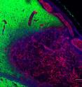 Four weeks after a TBI lesion on a rat's brain with hydrogel treatment. This is a mosaic image reconstruction of the lesion. A well-structured vasculature network was rebuilt at the lesion filled with the hydrogel. Green is neurofilament staining for neurites, and red is Reca-1 staining for blood vessels.