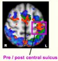 This is an fMRI image of the brain, viewed from above. New research shows that the changes in awareness we feel when preparing to do two incompatible actions are uniquely associated with increased activity in areas of the brain used for working memory, including the pre and post central sulcus. These areas are responsible for consciousness and selecting the right action at the right time. This finding supports San Francisco State University Professor Ezequiel Morsella's new theory that it is consciousness that resolves the dilemma of conflicting urges. The findings were presented at the Proceedings of the Cognitive Neuroscience Society Annual Meeting in April 2008.