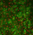 These are liver cells generated from skin that are shown to make human liver proteins Albumin in green and HNF4 in red.